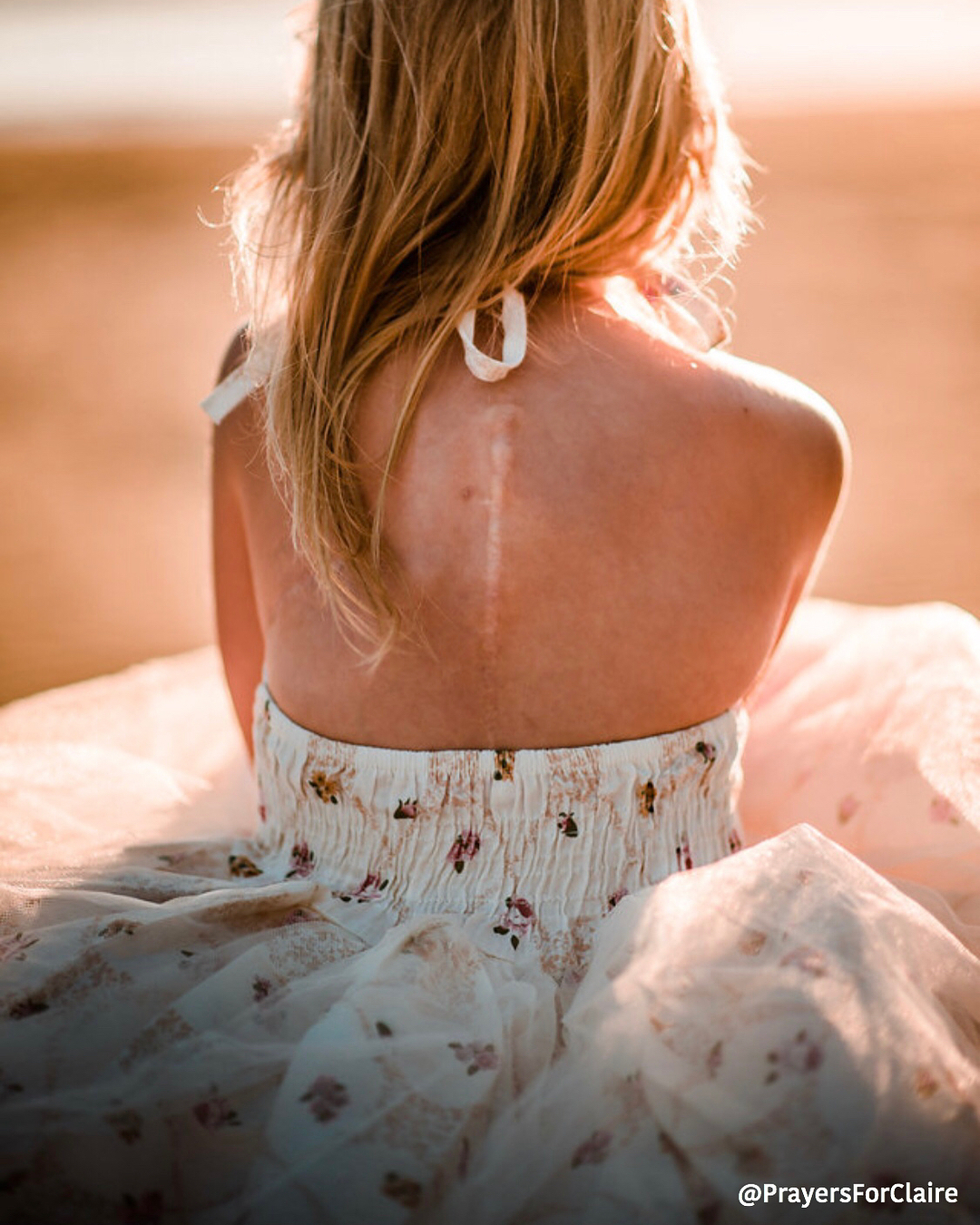 This Mom’s Comeback to a Bully’s Scar Comment