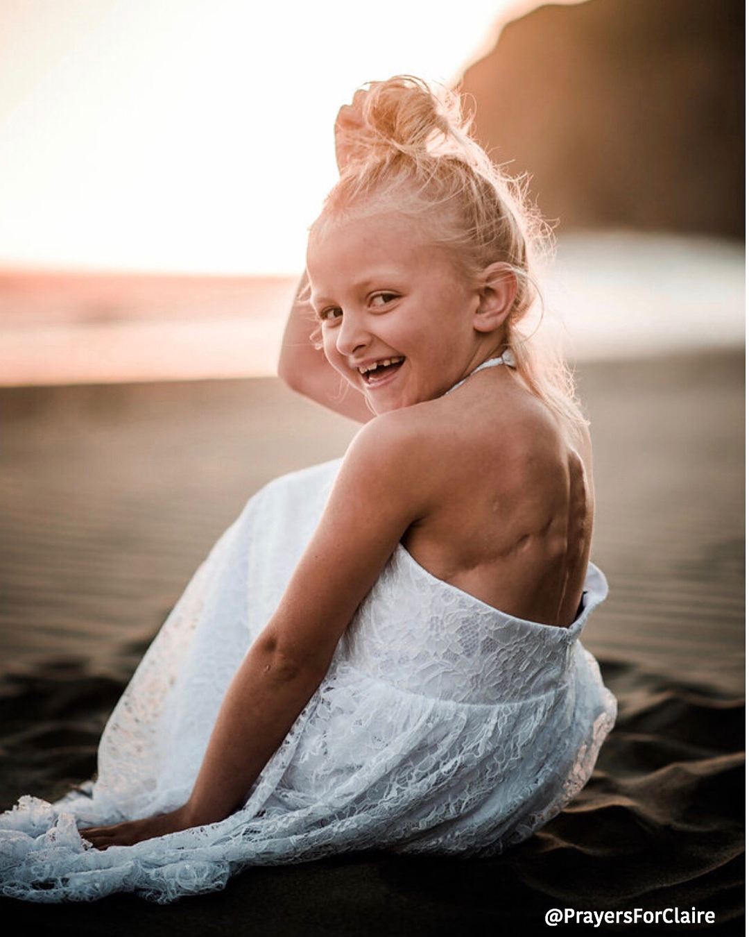 This Mom’s Comeback to a Bully’s Scar Comment