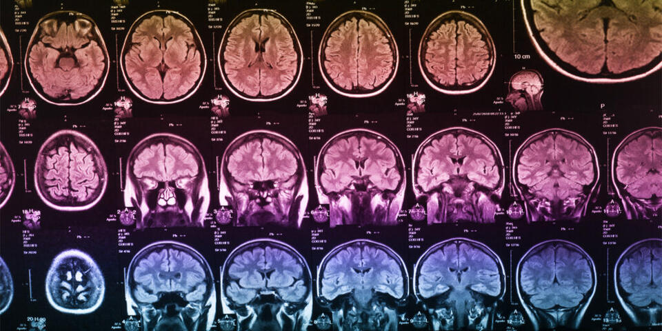 Psychopath Brains Are Actually Different?