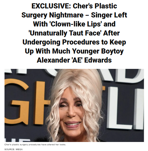 Cher’s Face Has Fans Doing Double Takes