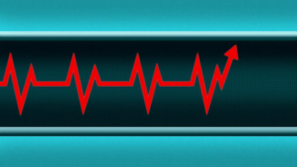 Why Everyone’s Suddenly Buying UnitedHealth Stock