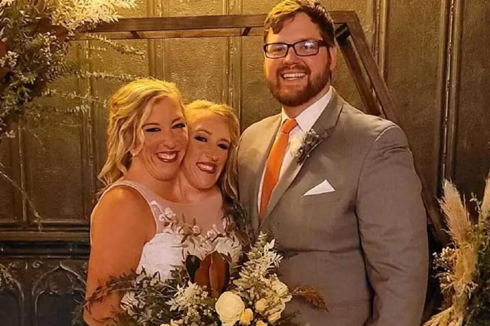 Abby and Brittany Hensel’s new chapter in Minnesota