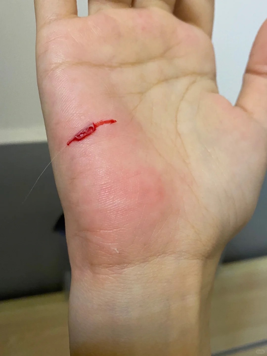 Braided line cut through my hand like a knife! 🩸