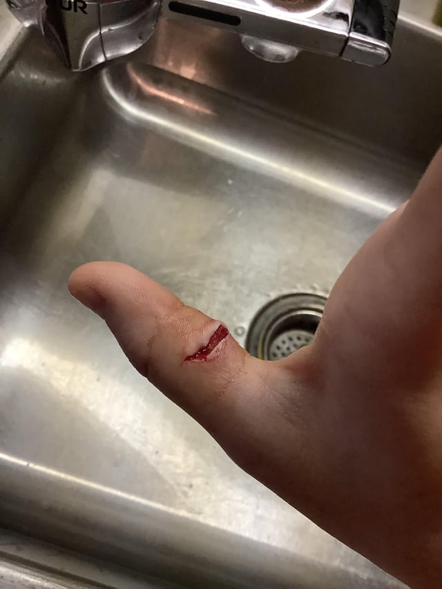 Almost needed stitches filleting this snakehead! 🔪
