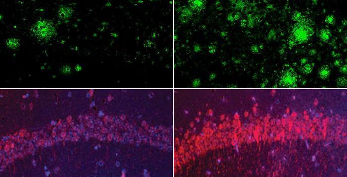 Could Lithium Be the Brain’s Secret Defender?