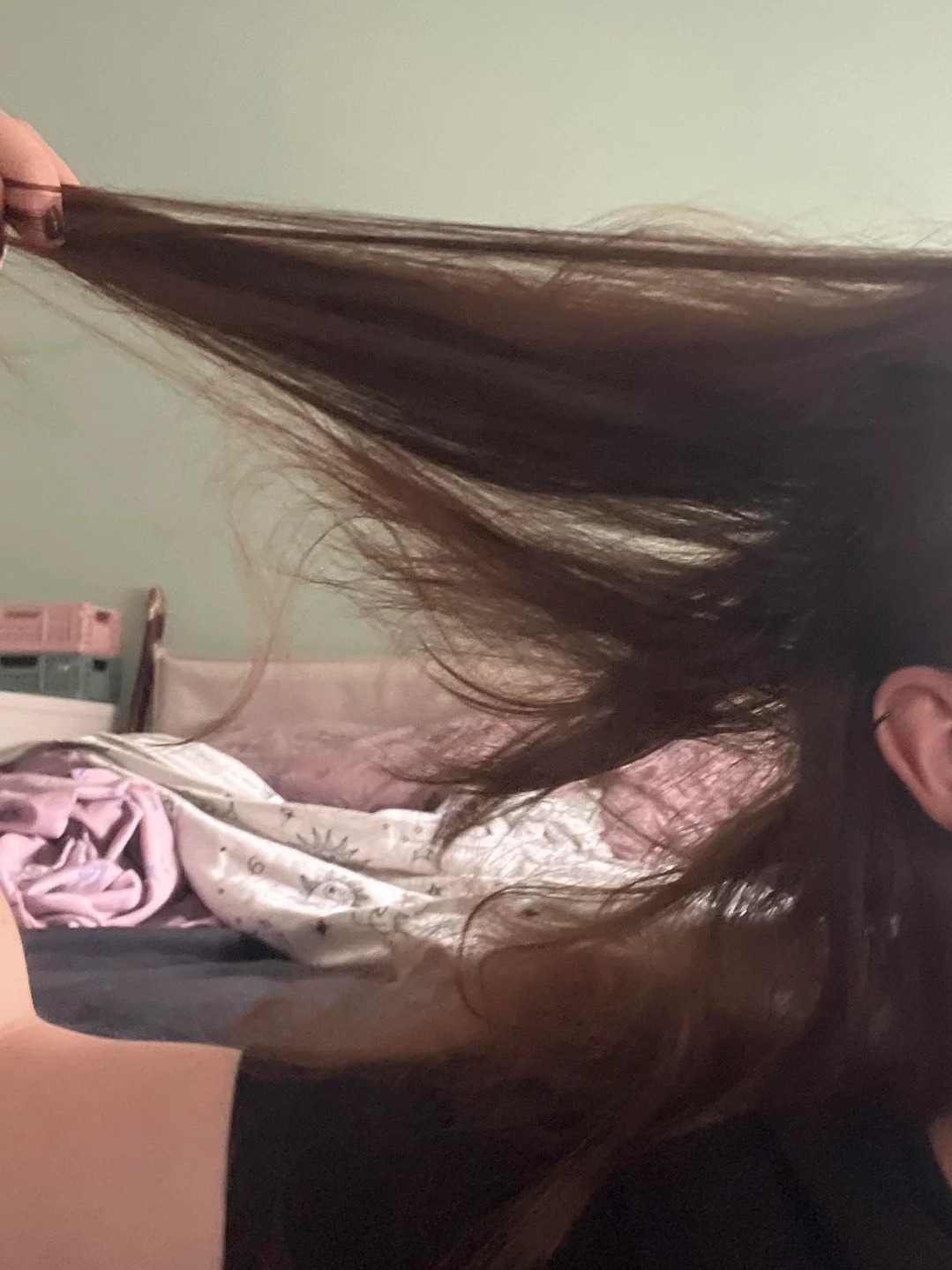 I Woke Up And Half My Hair Is Suddenly Short No Explanation 🤯