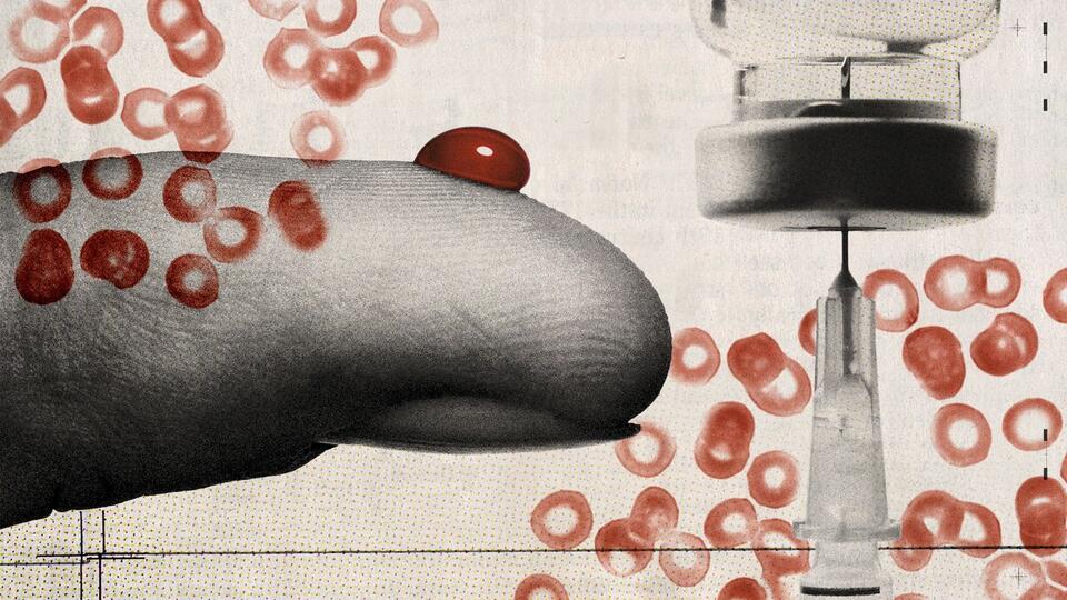 Did We Just Find Type 3 Diabetes?