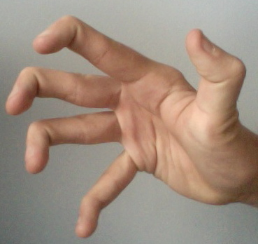 The "Best Disease" That Gives You Amazing Skin