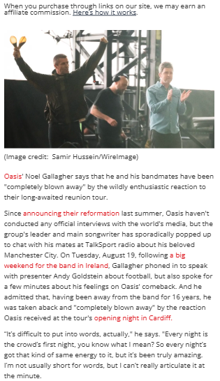 Noel & Liam’s Reunion Shock 😱