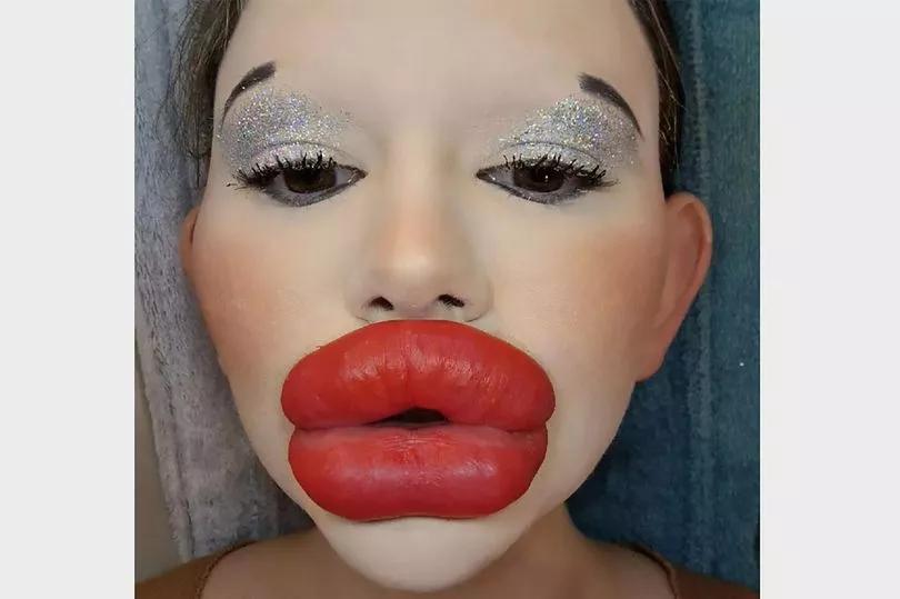 You Won’t Believe Her Lip Transformation