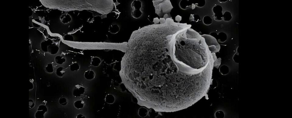 Meet the Virus With a Record-Breaking Tail