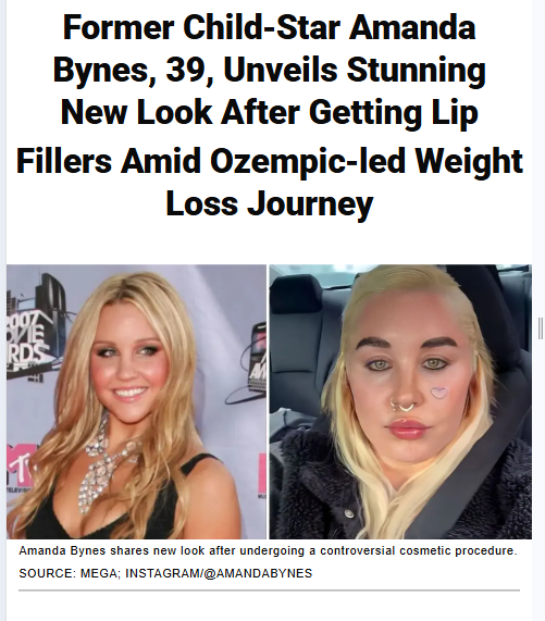 Amanda Bynes’ Glow-Up: Lip Fillers & Ozempic!