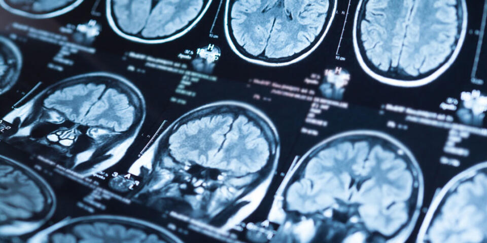 PTSD Isn’t Just About Trauma—It’s Complicated