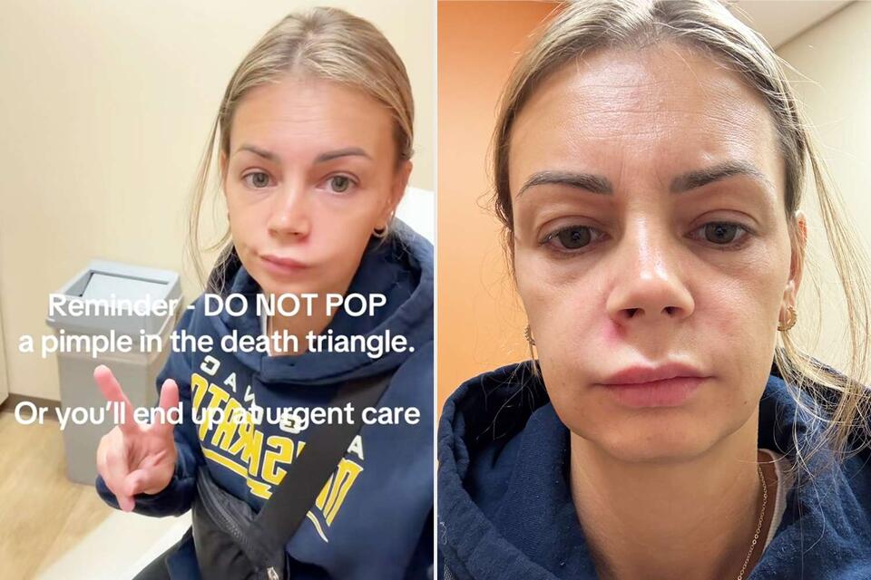 Popped a Pimple, Ended Up in Urgent Care?!