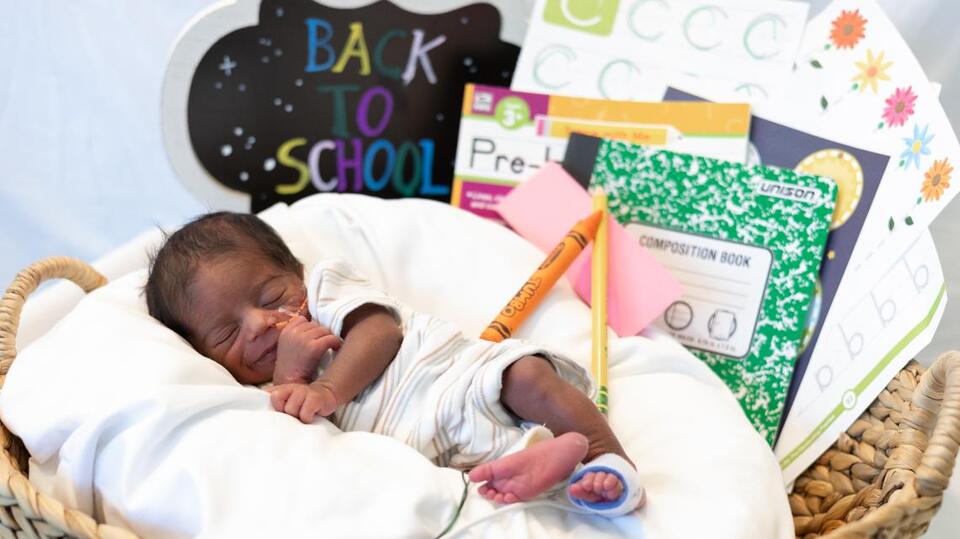 Tiny NICU grads shine in Dallas hospital photoshoot