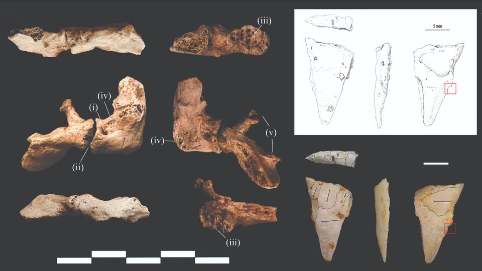 Stone Age Murder Mystery: Arrow Attack?
