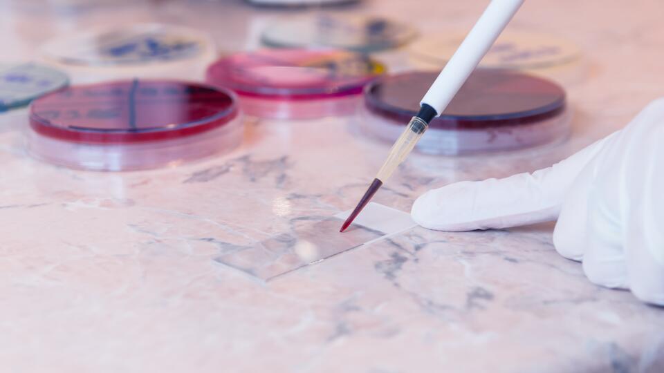 Tropical Plant Compound vs. Leukaemia?