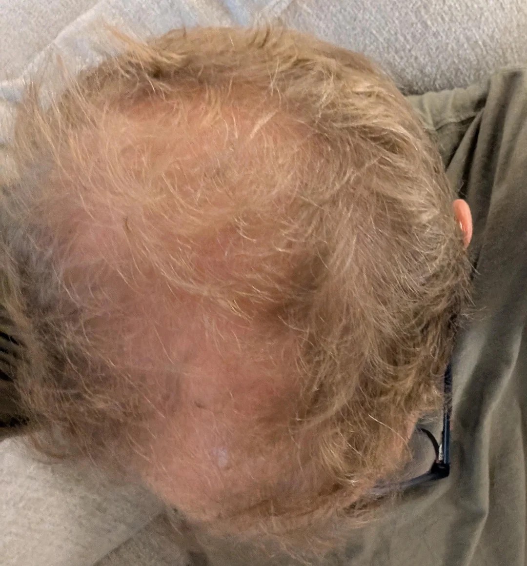 Divorced and Shaved My Head! My Life Just Got a Whole Lot Bolder!