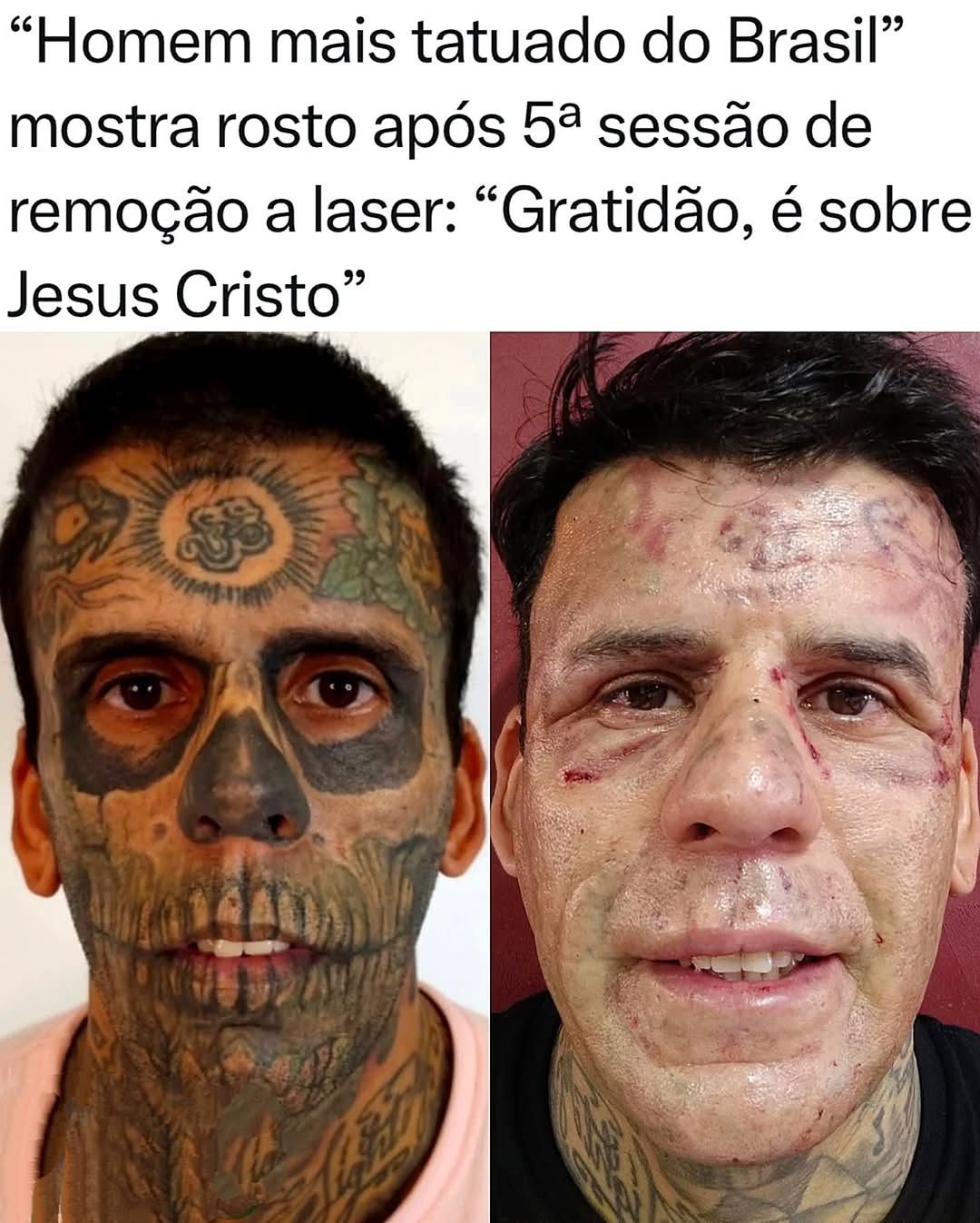 From Brazil’s Most Tattooed to Fresh Start