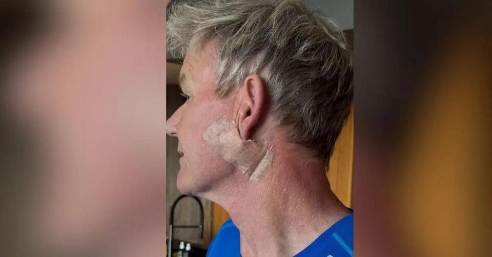 Gordon Ramsay’s Cancer Scare & Epic PSA