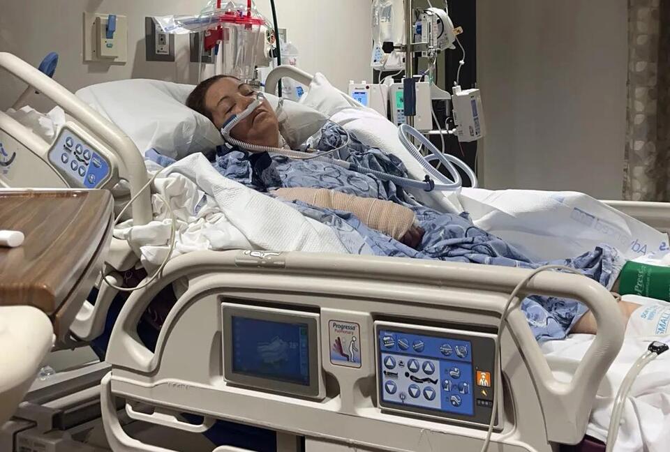 Texas mom’s fight for prosthetics after dog attack