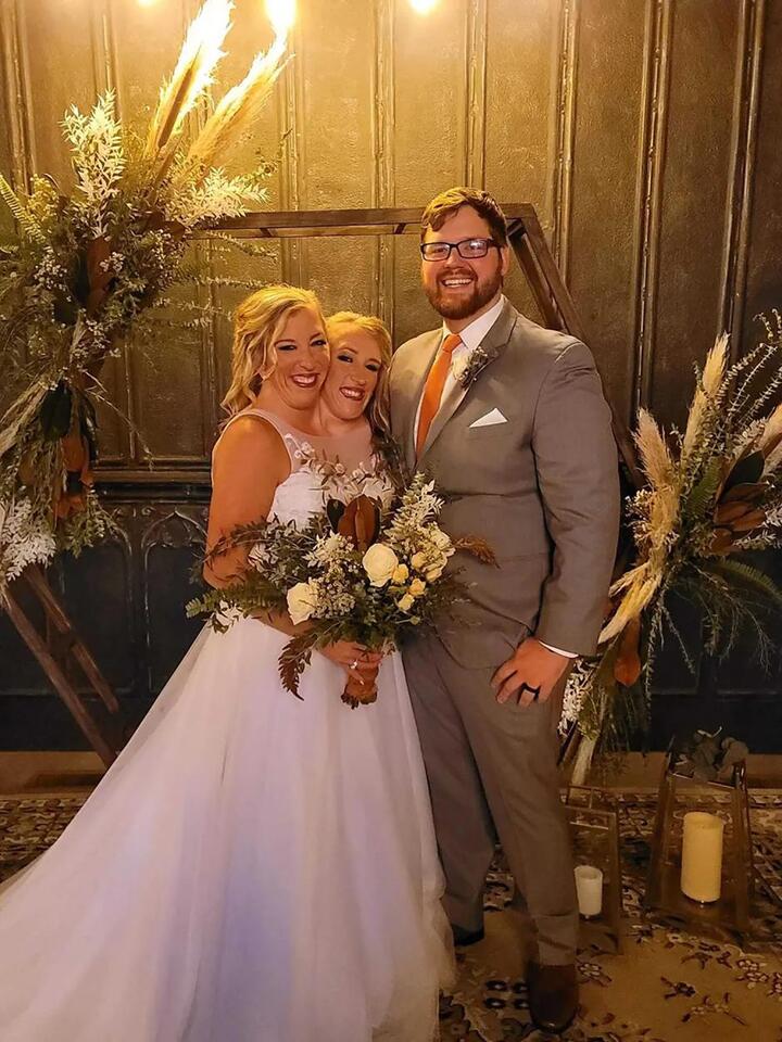 Abby & Brittany Hensel’s Baby Reveal!