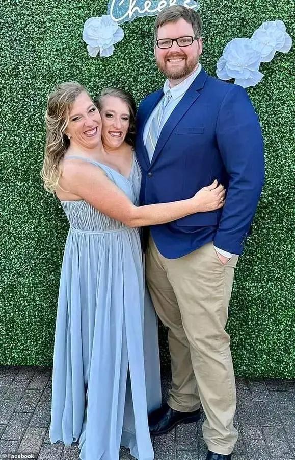 Abby & Brittany Hensel’s Baby Reveal!