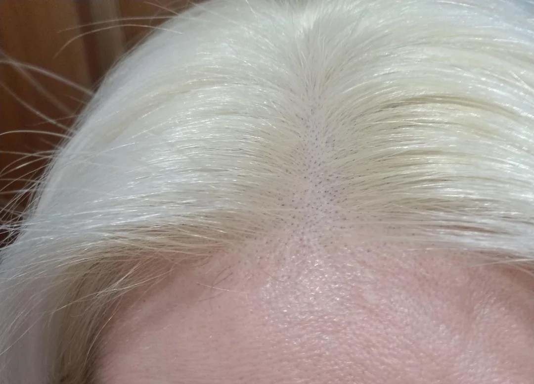 I have regrowth just 15 hours after bleaching my roots!?