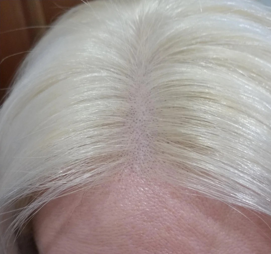 I have regrowth just 15 hours after bleaching my roots!?