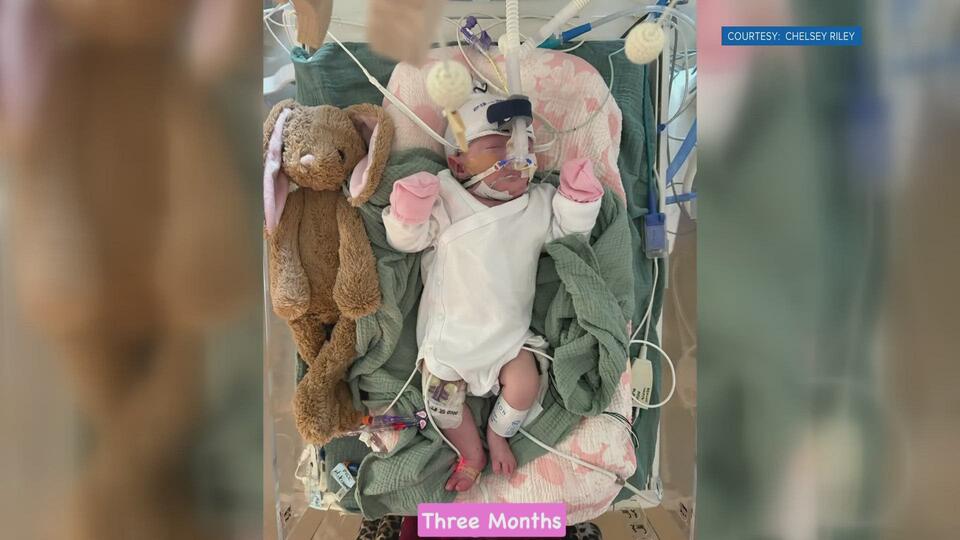 Knoxville mom’s fight for her Trisomy 18 baby