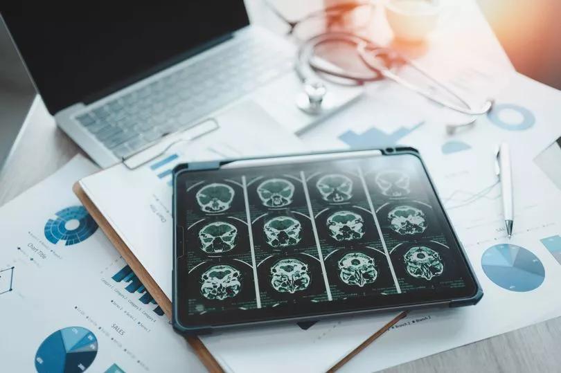 Your Eyes Could Reveal Dementia Early?!