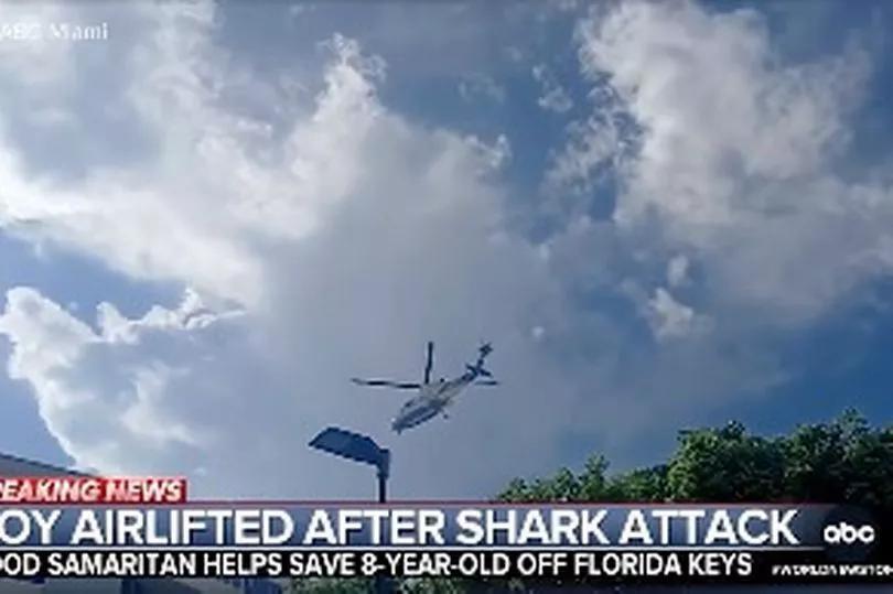 Florida boy survives shark bite on Labor Day