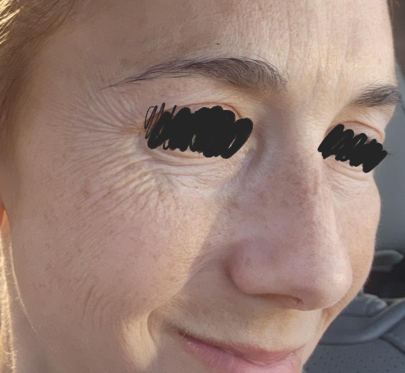 I'm in My Late 30s but My Skin Looks 70. Is There Any Hope?