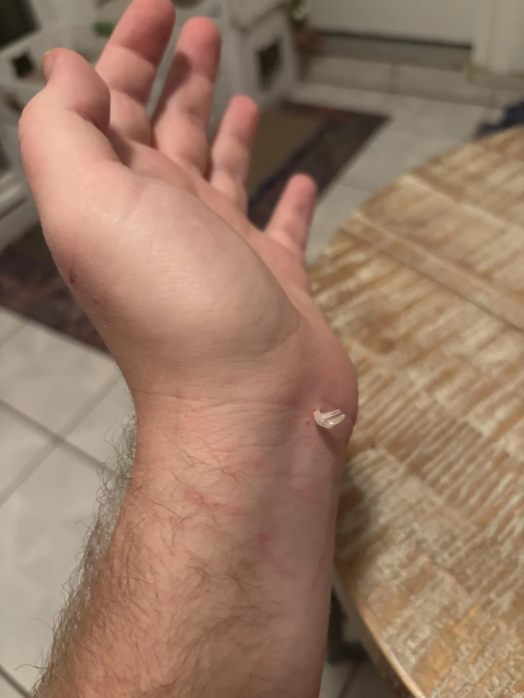cat shed an entire claw in someone's wrist😆