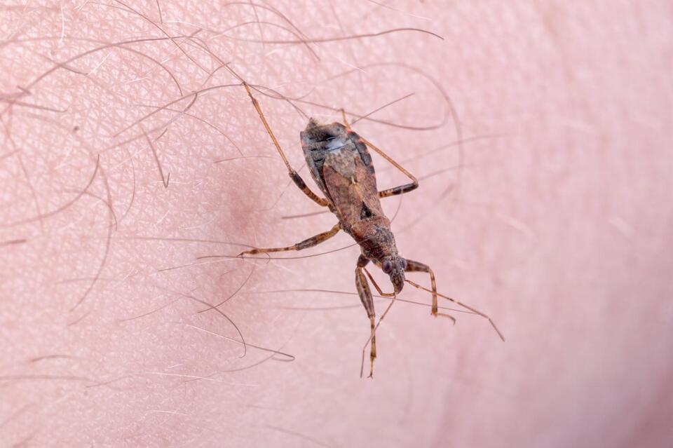 Kissing Bug Disease: The Silent US Spread