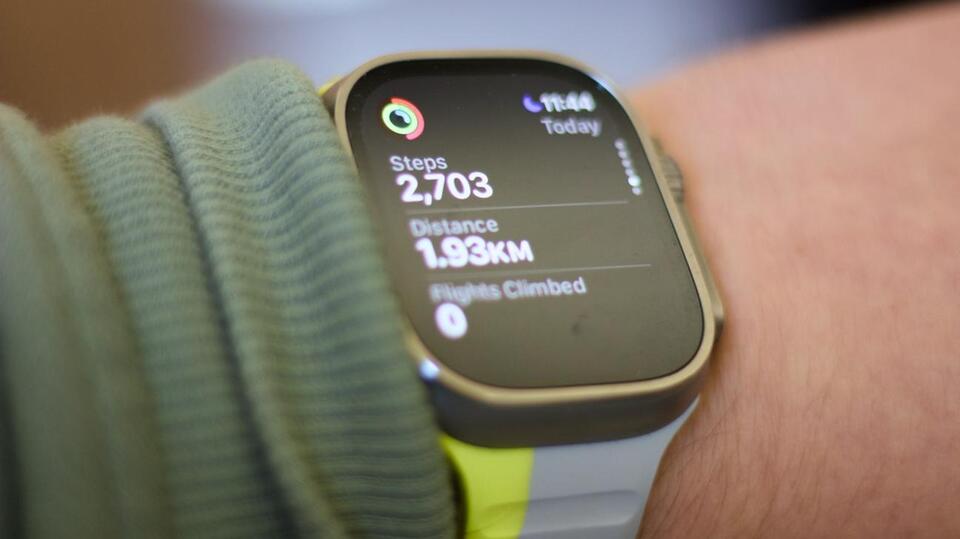 Apple Watch 11: Brighter Screens, Real Progress?