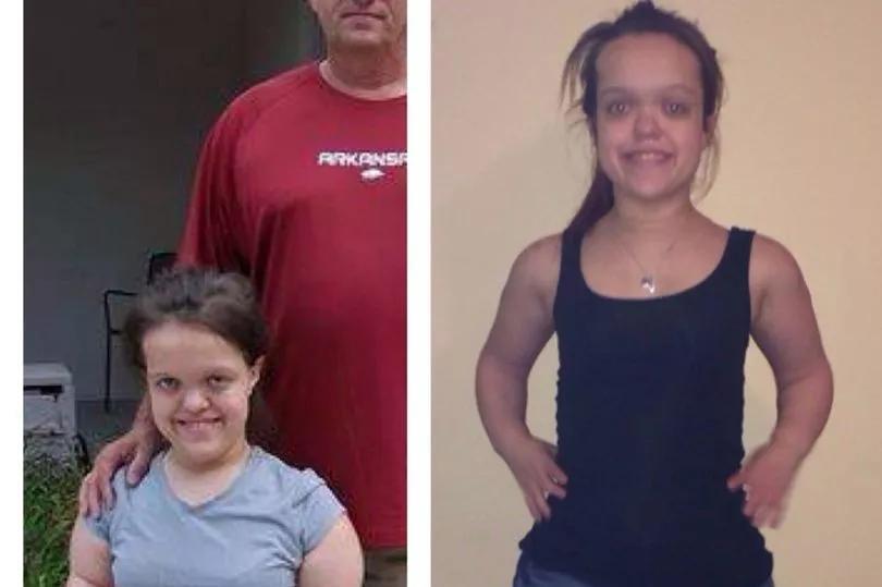 She grew 13 inches—here’s how it changed her life