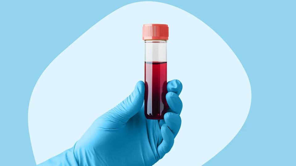 Is a Type 1 Diabetes Cure Finally Coming?