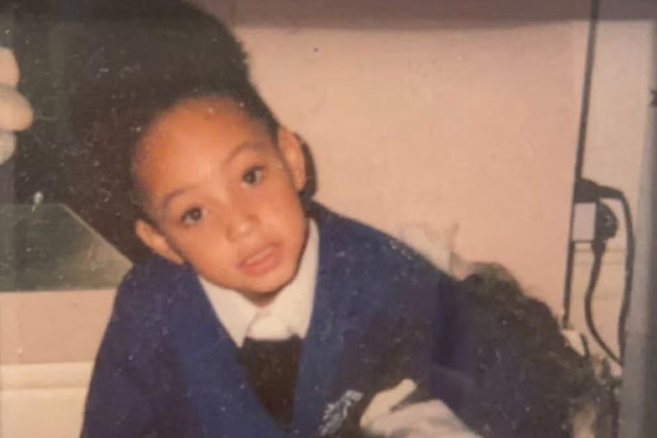Living with a rare autoimmune disorder at 23