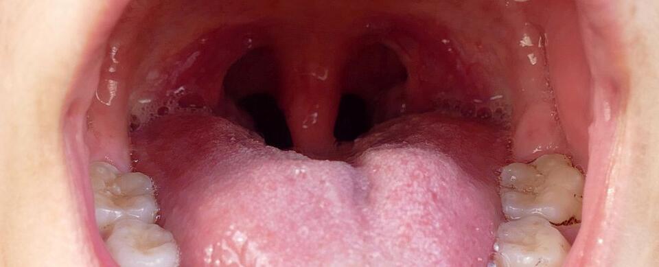 Your Mouth Might Be Messing With Your Heart
