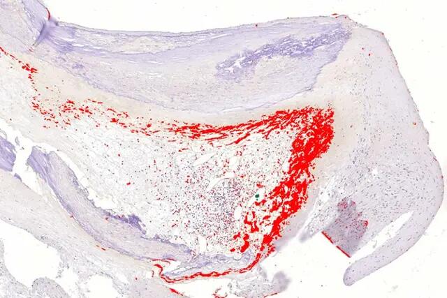 Your Mouth Might Be Messing With Your Heart