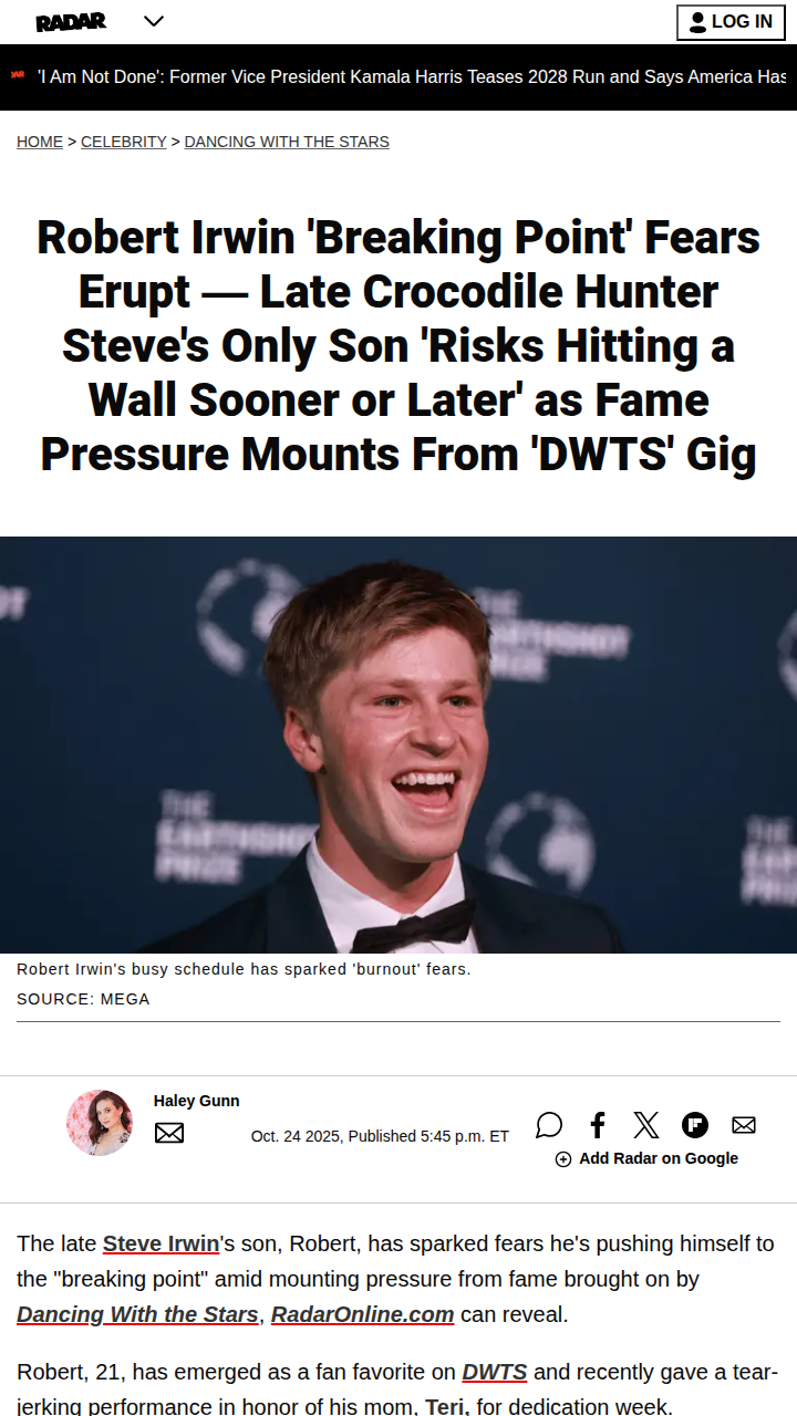 Robert Irwin DWTS Burnout Rumors 😬