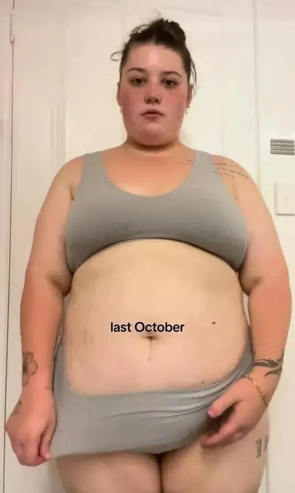 How Pru Dropped 10st—No Jabs, No Surgery!