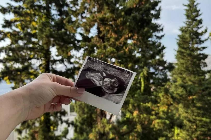 Private Baby Scans: What Went Wrong?