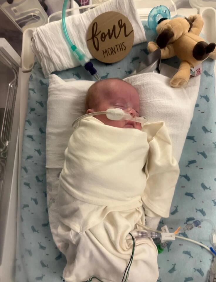 Texas family's miracle baby beats the odds