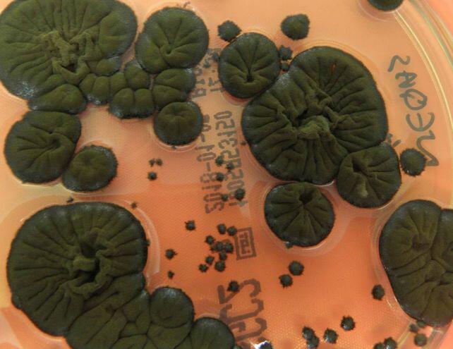 Chernobyl Fungus Is Basically a Superhero