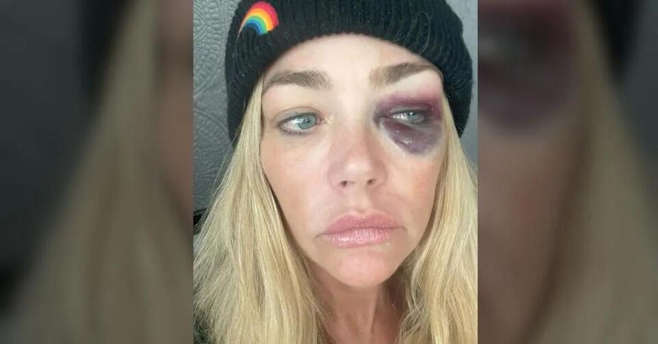 Denise Richards’ Divorce Drama Just Got Wilder
