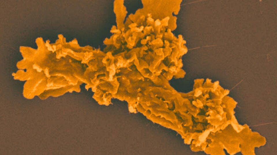 This Amoeba Is Basically Lava-Proof