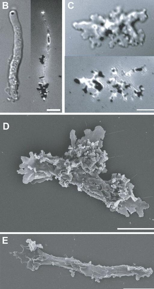 This Amoeba Is Basically Lava-Proof