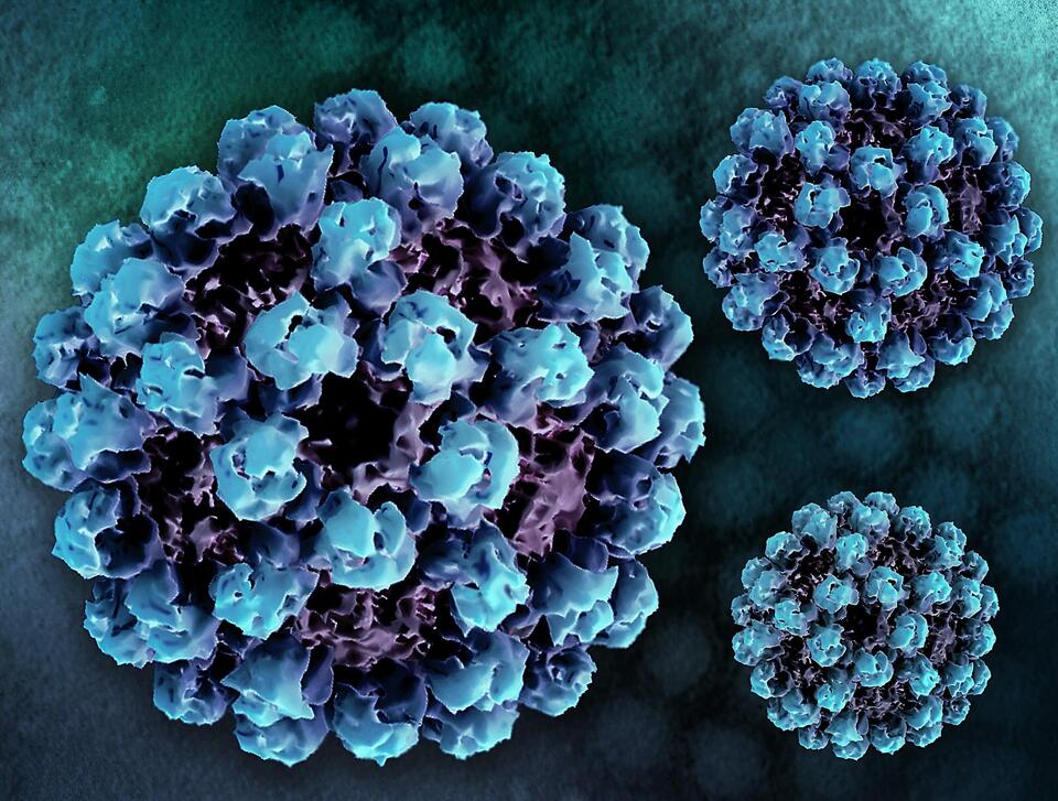 Norovirus Is Back—And Early!